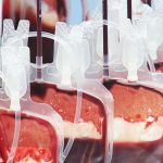 NHS issues urgent blood donation appeal following cyber attack